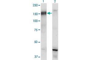 Western Blot analysis of BCR expression in transfected 293T cell line by BCR monoclonal antibody (M01), clone 2E5.