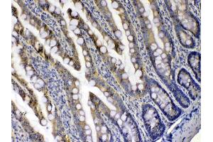 IHC analysis of Xanthine Oxidase using anti-Xanthine Oxidase antibody .
