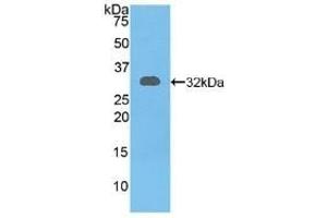 Detection of Recombinant RYK, Mouse using Polyclonal Antibody to Related To Receptor Tyrosine Kinase (RYK) (RYK anticorps  (AA 287-533))