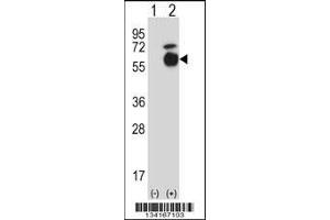 Western blot analysis of Acvr1 using rabbit polyclonal Mouse Acvr1 Antibody using 293 cell lysates (2 ug/lane) either nontransfected (Lane 1) or transiently transfected (Lane 2) with the Acvr1 gene. (ACVR1 anticorps  (AA 137-166))