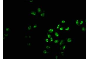 Immunofluorescence staining of Hela cells with ABIN7163056 at 1:233, counter-stained with DAPI. (PHF6 anticorps  (AA 2-312))