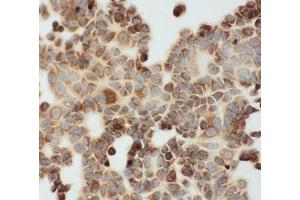 ICC testing of MCF-7 cells (DLD anticorps  (C-Term))