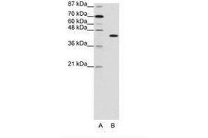 Image no. 1 for anti-PiggyBac Transposable Element Derived 1 (PGBD1) (N-Term) antibody (ABIN202923) (PGBD1 anticorps  (N-Term))