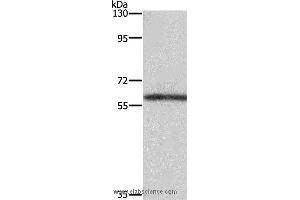Western blot analysis of Mouse kidney tissue, using TBX5 Polyclonal Antibody at dilution of 1:350 (T-Box 5 anticorps)