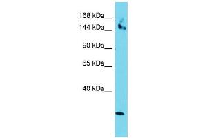 Host: Rabbit Target Name: CCDC141 Sample Type: HepG2 Whole Cell lysates Antibody Dilution: 1. (CCDC141 anticorps  (Middle Region))