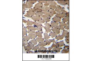 MGAT4C Antibody immunohistochemistry analysis in formalin fixed and paraffin embedded human skeletal muscle followed by peroxidase conjugation of the secondary antibody and DAB staining. (MGAT4C anticorps  (C-Term))