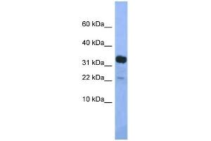 WB Suggested Anti-Klhdc9 Antibody Titration: 1. (KLHDC9 anticorps  (Middle Region))