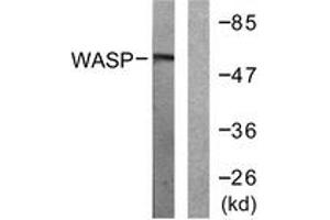 Western blot analysis of extracts from HepG2 cells, using WASP (Ab-290) Antibody. (WASP anticorps  (AA 256-305))