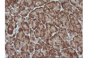 Image no. 2 for anti-Melanoma Antigen Family A, 4 (MAGEA4) antibody (ABIN1499260)