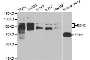 Western blot analysis of extracts of various cell lines, using EZH2 antibody.