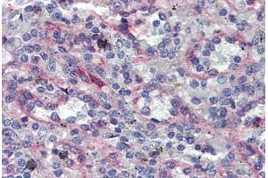 Human Spleen: Formalin-Fixed, Paraffin-Embedded (FFPE)