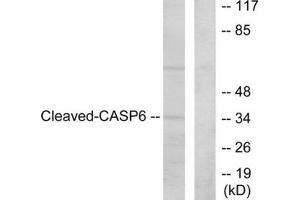 Western blot analysis of extracts from HeLa cells, treated with etoposide (25 μM, 1hour), using Caspase 6 (cleaved-Asp162) antibody. (Caspase 6 anticorps  (Cleaved-Asp162))