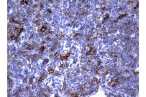 Image no. 3 for anti-Fc Fragment of IgE, Low Affinity II, Receptor For (CD23) (FCER2) (AA 48-321) antibody (ABIN1491554) (FCER2 anticorps  (AA 48-321))