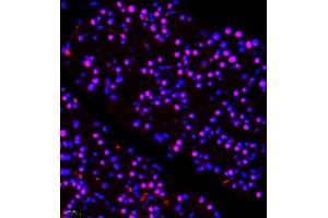 Immunofluorescence of paraffin embedded rat pancreas using ALS2CR13 (ABIN7073909) at dilution of 1:650 (400x lens) (FAM117B anticorps)