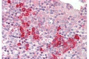 Rabbit Anti-SNRPD1 antibody  Formalin Fixed Paraffin Embedded Tissue: Human Tonsil Primary antibody Concentration: 1:200 Secondary Antibody: Donkey anti-Rabbit-Cy3 Secondary Antibody Concentration: 1:200 Magnification: 20x Exposure Time: 0. (SNRPD1 anticorps  (N-Term))