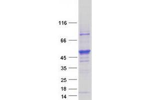 Validation with Western Blot