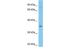 Host:  Rabbit  Target Name:  NCEH1  Sample Type:  THP-1 Whole Cell lysates  Antibody Dilution:  1. (NCEH1 anticorps  (C-Term))
