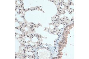 Immunohistochemistry of paraffin-embedded Mouse lung using Thioredoxin 1 (Trx1/Thioredoxin 1 (Trx1/TXN)) antibody (ABIN7270798) at dilution of 1:100 (40x lens). (TXN anticorps  (C-Term))