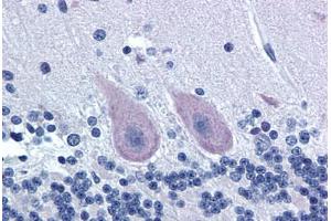 Human Brain, Cerebellum (formalin-fixed, paraffin-embedded) stained with GRM1 antibody ABIN239868 at 20 ug/ml followed by biotinylated goat anti-rabbit IgG secondary antibody ABIN481713, alkaline phosphatase-streptavidin and chromogen.
