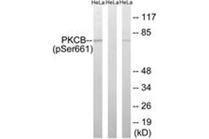 Western blot analysis of extracts from HeLa cells treated with heat shock, using PKCB (Phospho-Ser661) Antibody. (PKC beta anticorps  (pSer661))