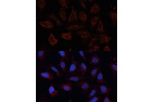Immunofluorescence analysis of U2OS cells using  antibody (ABIN6129706, ABIN6136901, ABIN6136902 and ABIN6214776) at dilution of 1:100. (ANO1 anticorps  (AA 628-731))