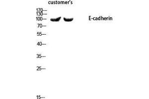 Western Blot (WB) analysis of using E-cadherin Polyclonal Antibody. (E-cadherin anticorps  (N-Term))