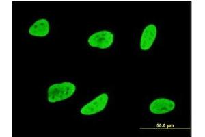 Immunofluorescence (IF) image for anti-serum/glucocorticoid Regulated Kinase 1 (SGK1) antibody (ABIN781842)