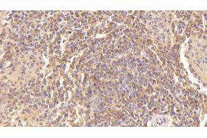 Detection of PF4 in Human Spleen Tissue using Monoclonal Antibody to Platelet Factor 4 (PF4) (PF4 anticorps  (AA 31-101))