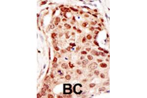 Immunohistochemistry (IHC) image for anti-Cbl proto-oncogene C (CBLC) antibody (ABIN2996838) (CBLC anticorps)