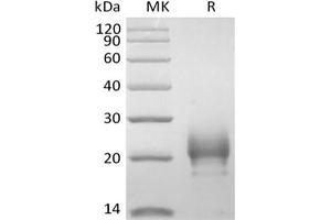 Western Blotting (WB) image for Thymic Stromal Lymphopoietin (TSLP) (Arg127Ala-Mutant), (Arg130Ala-Mutant) protein (His tag) (ABIN7319861) (Thymic Stromal Lymphopoietin Protein (TSLP) (Arg127Ala-Mutant, Arg130Ala-Mutant) (His tag))