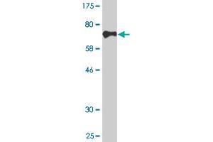 Western Blot detection against Immunogen (75. (CDR2 anticorps  (AA 1-454))