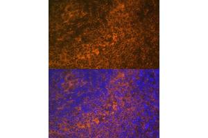 Immunofluorescence analysis of rat spleen using TNFRSF10A Polyclonal Antibody (ABIN6127583, ABIN6149301, ABIN6149303 and ABIN6216204) at dilution of 1:100 (40x lens).