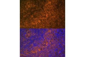 Immunofluorescence analysis of rat spleen using TNFRSF10A Polyclonal Antibody (ABIN6127583, ABIN6149301, ABIN6149303 and ABIN6216204) at dilution of 1:100 (40x lens). (TNFRSF10A anticorps  (AA 269-468))