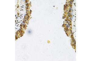 Immunohistochemistry of paraffin-embedded mouse lung using HSP90AB1 Antibody.