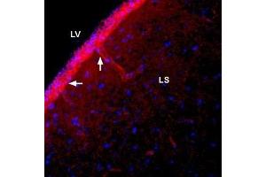Expression of NBCe1 in rat lateral septum - Immunohistochemical staining of immersion-fixed, free floating rat brain frozen sections using Anti-SLC4A4 (NBC1) (extracellular) Antibody (ABIN7043728, ABIN7044817 and ABIN7044818), (1:400).