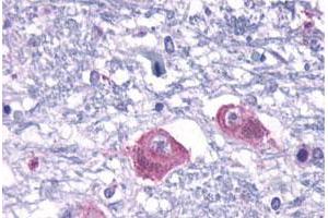 Immunohistochemical (Formalin/PFA-fixed paraffin-embedded sections) staining in human brain, neurons and glia with PTH2R polyclonal antibody .
