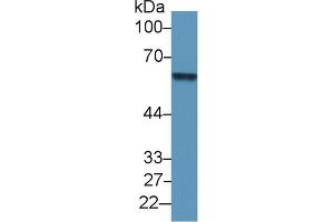 Western Blot; Sample: Human Lung lysate; Primary Ab: 1µg/ml Rabbit Anti-Human AT Antibody Second Ab: 0.