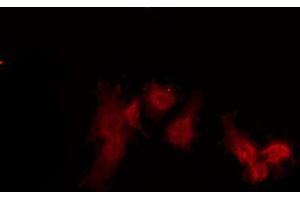 anti-Peropsin (RRH) (Internal Region) antibody