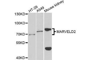 Western blot analysis of extracts of various cells, using MARVELD2 antibody. (Tricellulin anticorps)