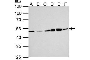 WB Image ERCC8 antibody [N2C2], Internal detects ERCC8 protein by Western blot analysis. (ERCC8 anticorps  (Internal Region))
