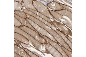 Immunohistochemical staining of human skeletal muscle with MURC polyclonal antibody  shows distinct cytoplasmic and membranous positivity in myocytes at 1:500-1:1000 dilution.