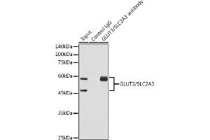 Immunoprecipitation analysis of 600 μg extracts of Mouse brain using 3 μg GLUT3/SLC2 antibody (ABIN7270415). (SLC2A3 anticorps)