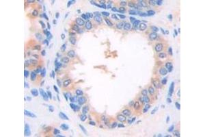 Used in DAB staining on fromalin fixed paraffin- embedded Kidney tissue