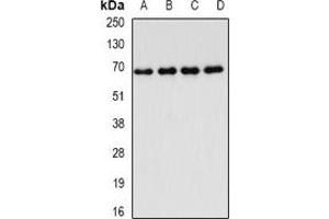 Western blot analysis of FIP1L1 expression in Jurkat (A), MCF7 (B), mouse thymus (C), rat lung (D) whole cell lysates.