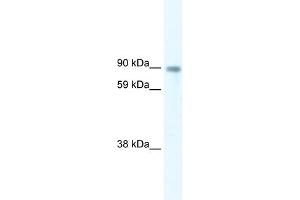 WB Suggested Anti-STAT5B Antibody Titration:  5. (STAT5B anticorps  (Middle Region))