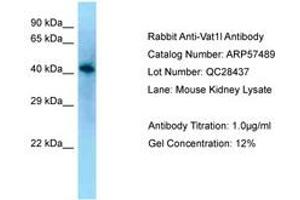 Image no. 1 for anti-Vesicle Amine Transport 1-Like (VAT1L) (AA 80-129) antibody (ABIN6749938) (VAT1L anticorps  (AA 80-129))