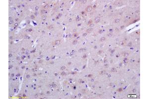 Formalin-fixed and paraffin embedded rat brain labeled with Rabbit Anti ACTH (1-39) Polyclonal Antibody, Unconjugated (ABIN668676) at 1:200 followed by conjugation to the secondary antibody and DAB staining (ACTH anticorps  (AA 1-39))