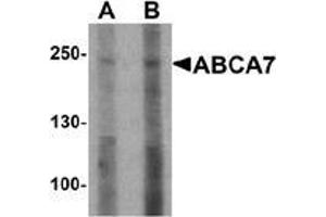 Western blot analysis of ABCA7 in 293 cell lysate with ABCA7 antibody at (A) 1 and (B) 2 ug/mL. (ABCA7 anticorps  (N-Term))