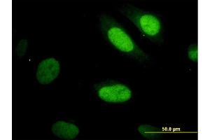 Immunofluorescence of monoclonal antibody to YAP1 on HeLa cell. (YAP1 anticorps  (AA 53-161))