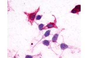 Anti-GPR182 / ADMR antibody immunocytochemistry (ICC) staining of HEK293 human embryonic kidney cells transfected with GPR182 / ADMR.